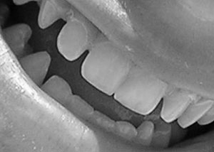 Detalle de la foto procesada