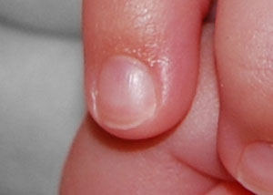 Detalle de la foto procesada