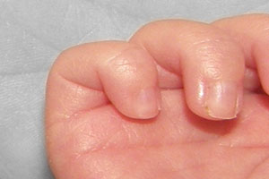 Detalle de la foto procesada