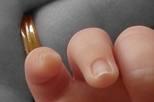 Detalle de la foto procesada