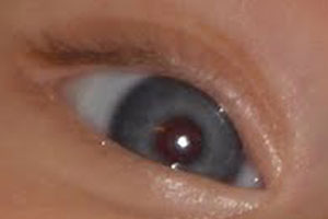 Detalle de la foto procesada