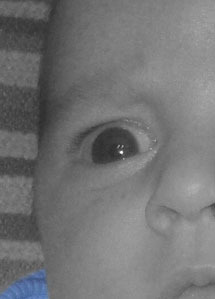 Detalle de la foto procesada