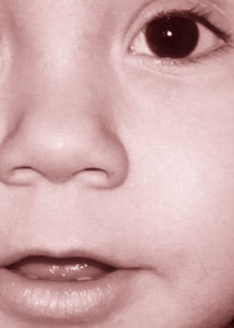 Detalle de la foto procesada